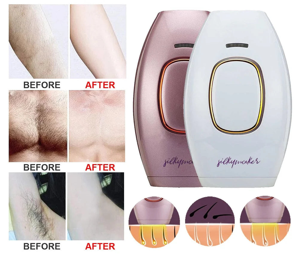 Hair Removal Handset, Advanced Diy Ipl Laser For Men And Women, Permanent Hair Reduction At Home, Works For Body And Facial Hair, 500,000 Flashes,12 Months Warranty By Erikka(White)